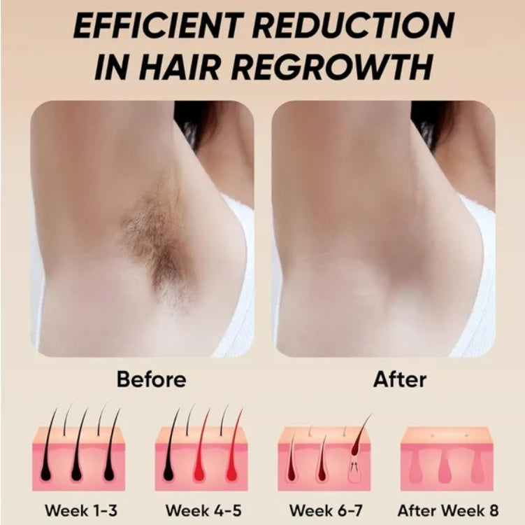 PureVivea™ SilkPro™ IPL Handset